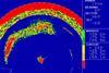 Koden ESR-S1BB 360° scanning sonar from Mantsbrite